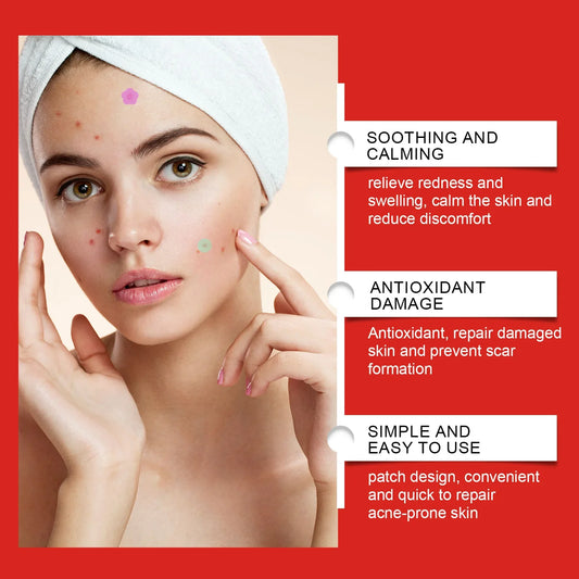 240 Pcs Pimple Patches – Heart/Star-Shaped Acne Dots
240 pieces of pimple patches with heart and star shapes, designed to cover acne and blemishes while providing moisture and care for your skin.